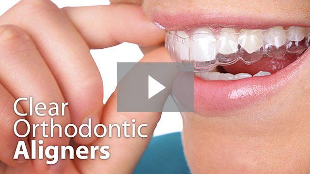 Clear Orthodontic Aligners Video Thumbnail Images 