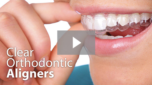 invisible Orthodontic Treatment (Braces)