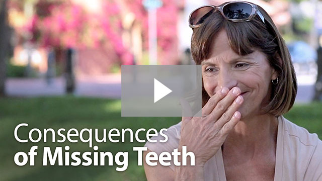 Consequences of Missing Teeth