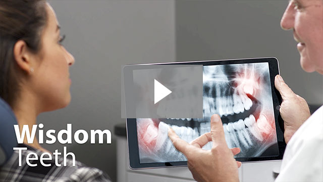 Wisdom Teeth Video