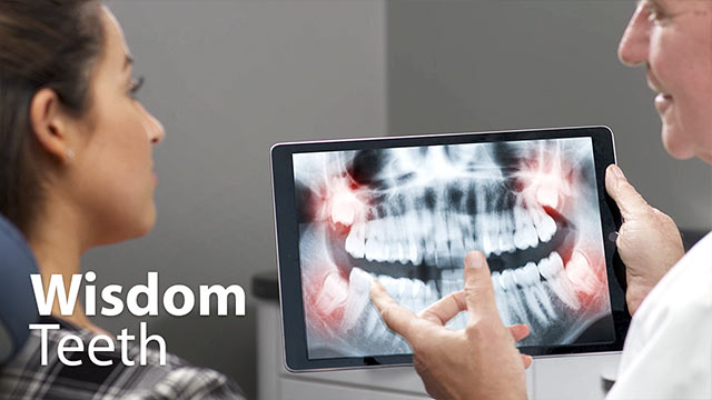 Wisdom Teeth Video