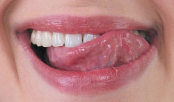 Image displaying the tongue test.