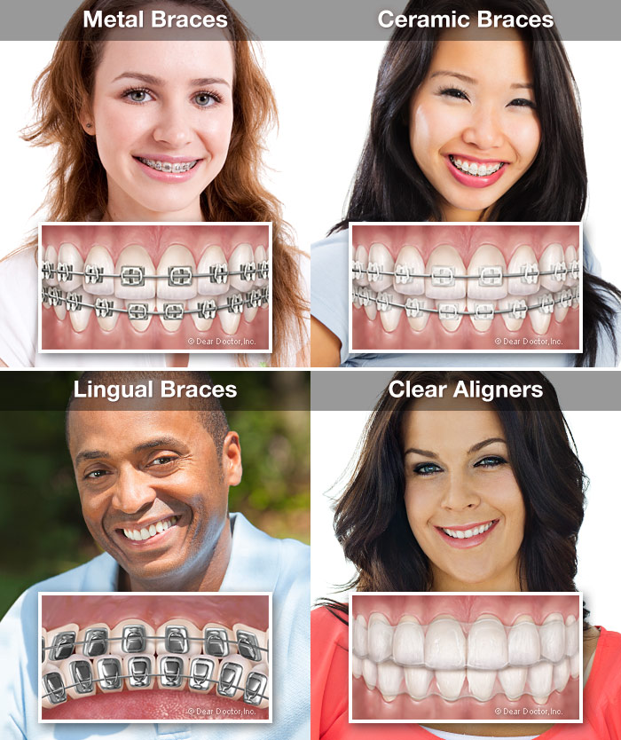 Orthodontist In Reston