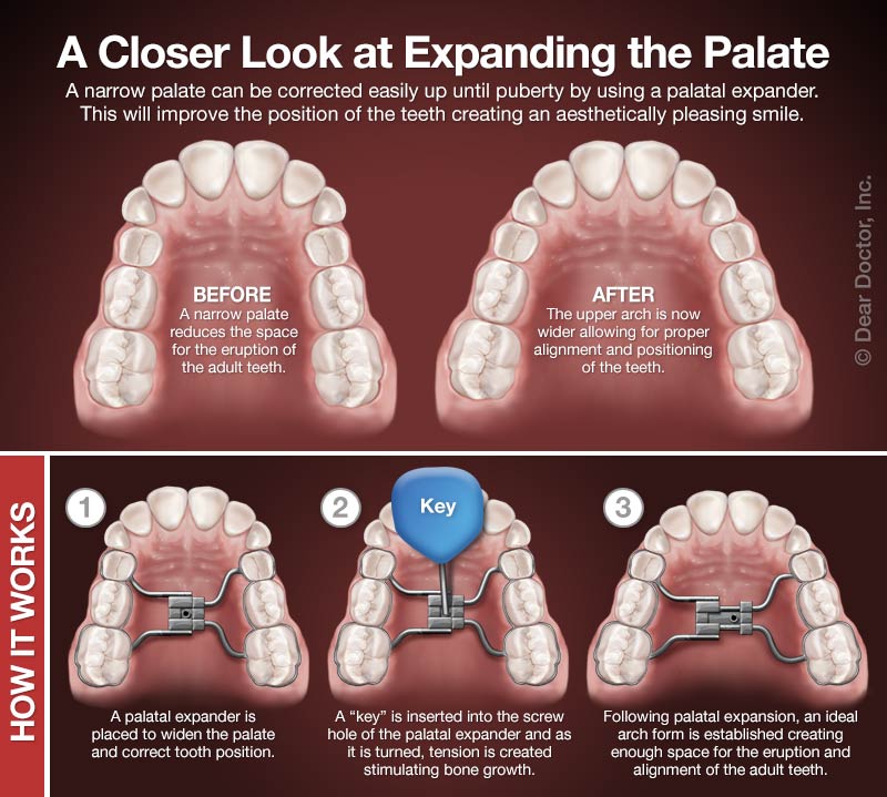 Are you in need of orthodontic treatment & what do you look for in