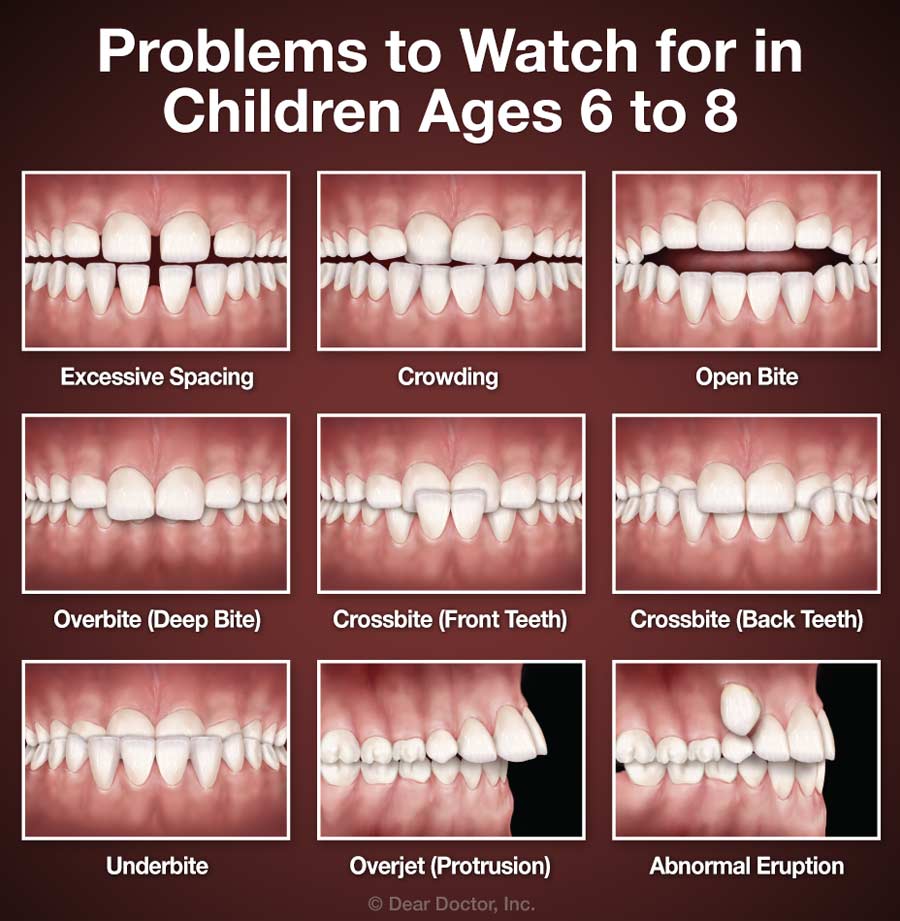 Orthodontic Problems in Children chart