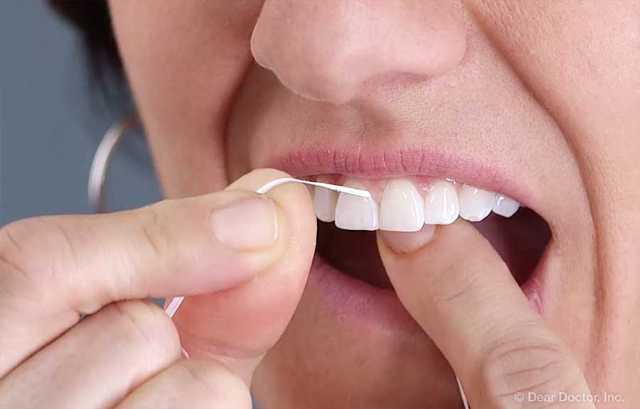 How Floss Your Teeth | Eastern Virginia Pediatric Dentistry | Norfolk Virginia