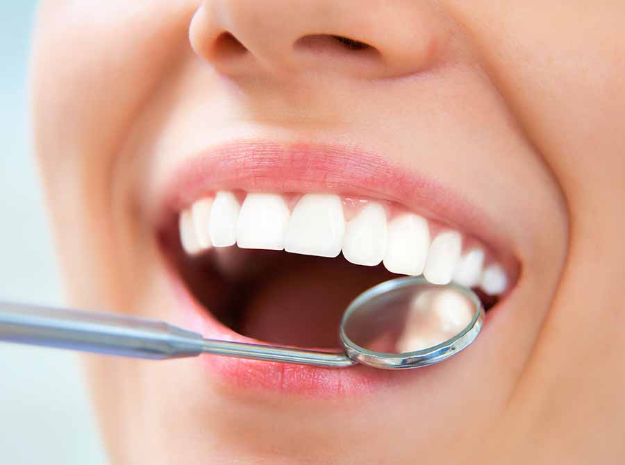 Oral Hygiene | All About Teeth | Tandblekning