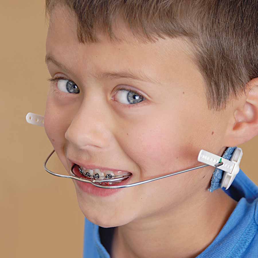 Child wearing orthodontic headgear.