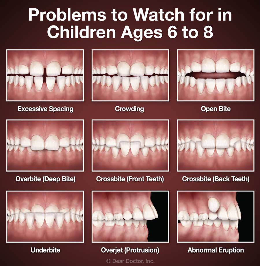 Invisalign Austin