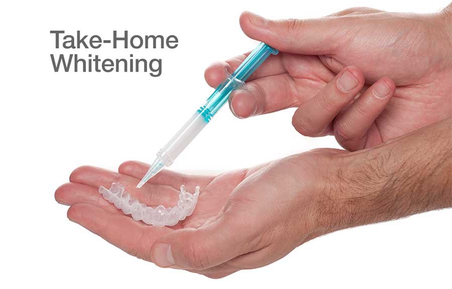 Take-Home Teeth Whitening.