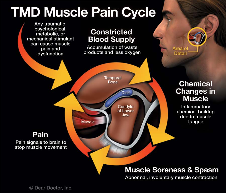 Tmj Enlarged