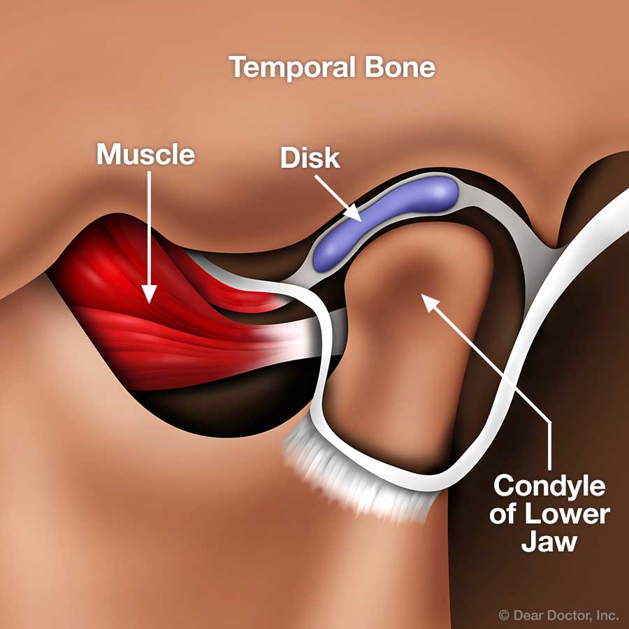 Jaw and Temporomandibular Joint: Anatomy