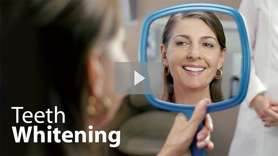 Teeth Whitening video