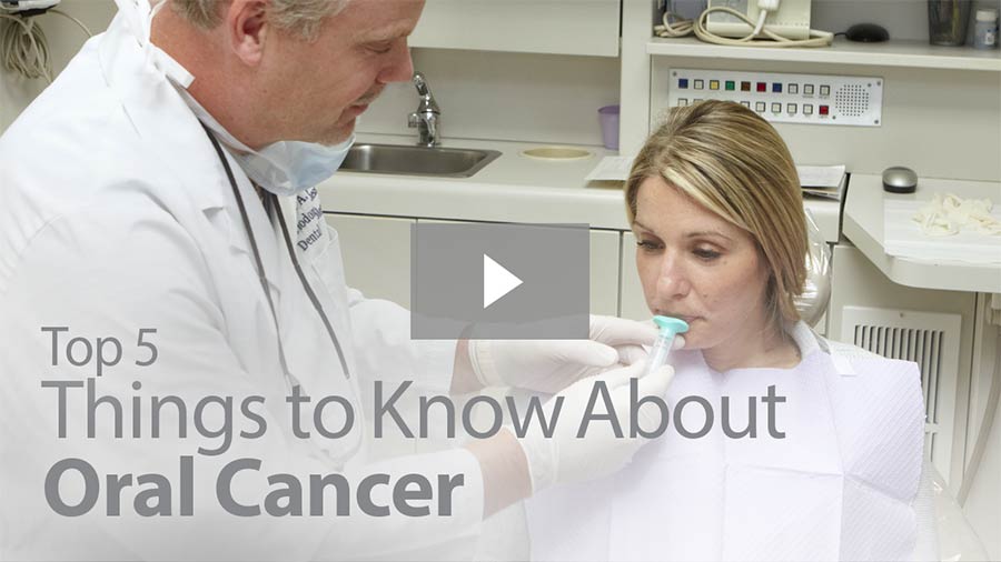Top 5 Things to Know About Oral Cancer video