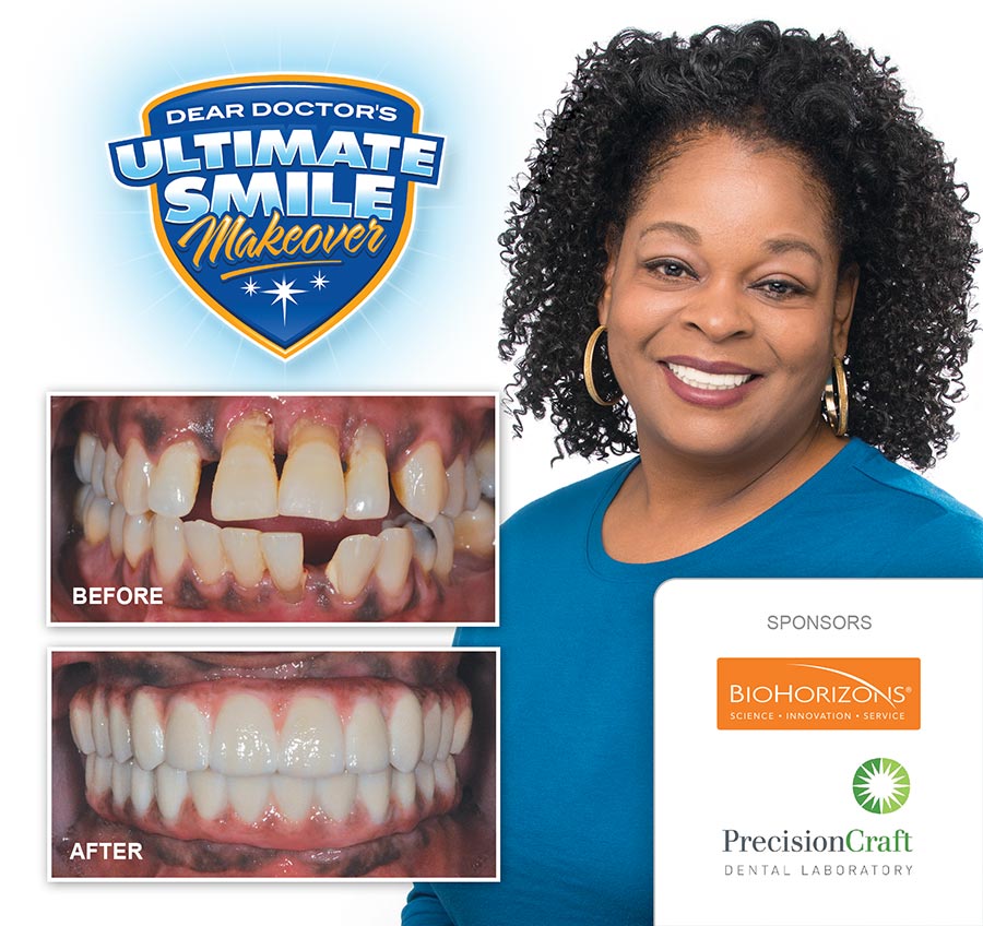 Celeste smile makeover before and after.