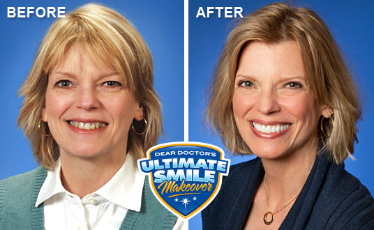 Smile makeover before and after.