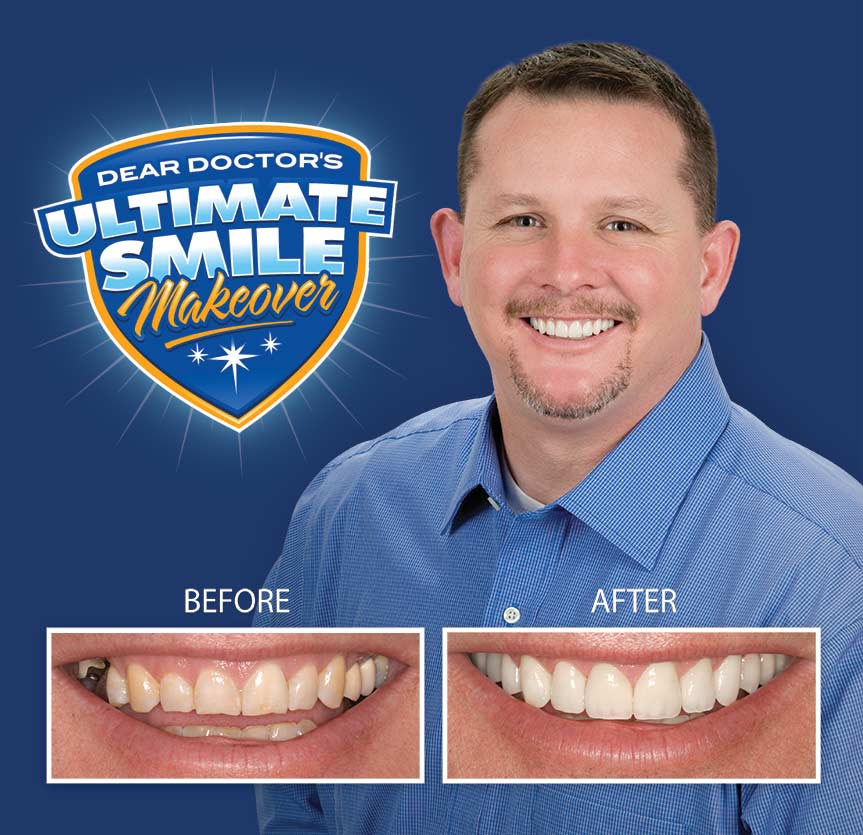 Smile makeover before and after.