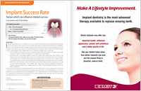 Dental Implant Success Rate - Dear Doctor Magazine