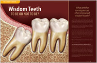 Wisdom Teeth â€“ Dear Doctor Magazine