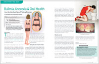 Bulimia Anorexia - Dear Doctor Magazine