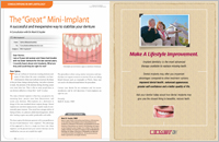 Dental Implants - Dear Doctor Magazine