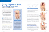 Root Canal Treatment - Dear Doctor Magazine